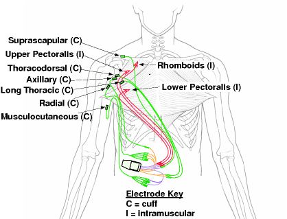Functional electrical stimulations